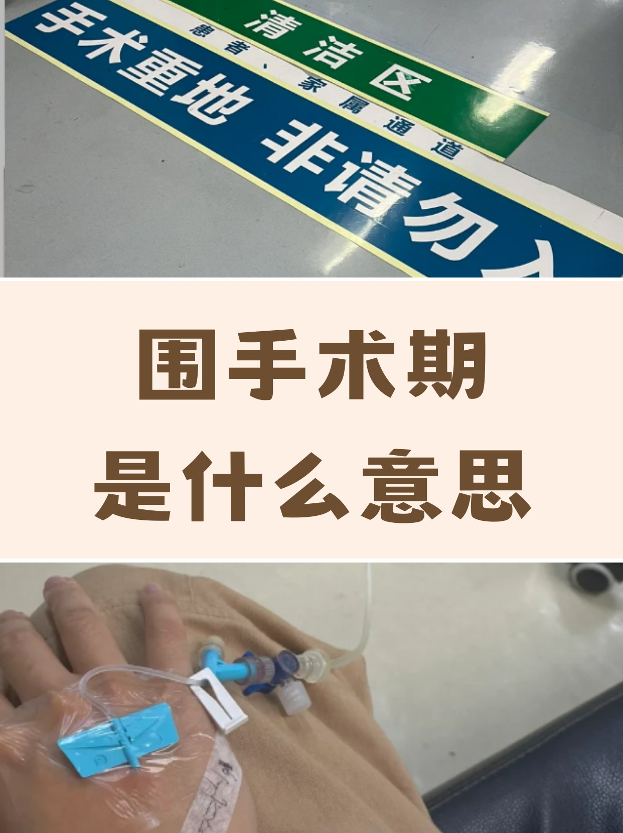 围手术期是指从患者决定接受手术治疗到手术结束及恢复期间的整个时间