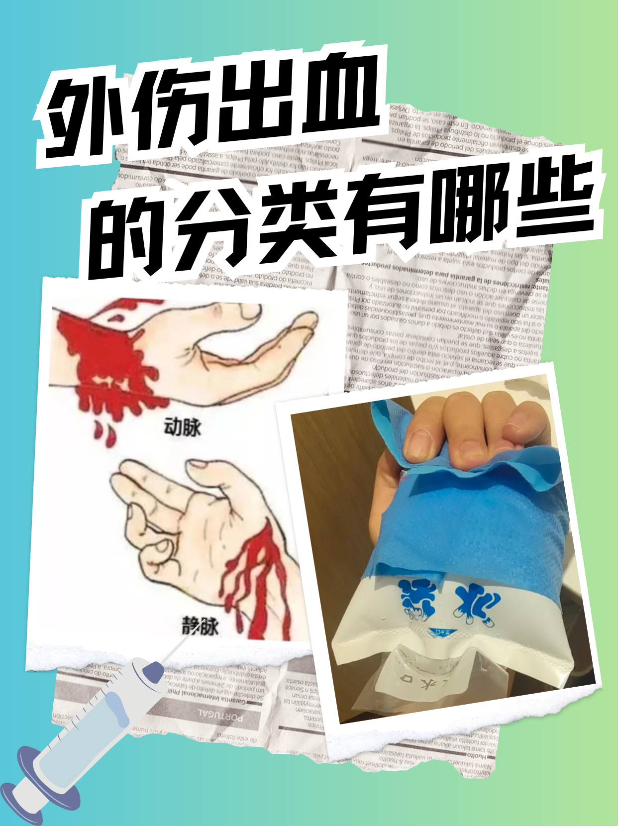 外伤出血分类有哪些 3月3日,我在面诊的时候,遇见一位这样紧急的患者