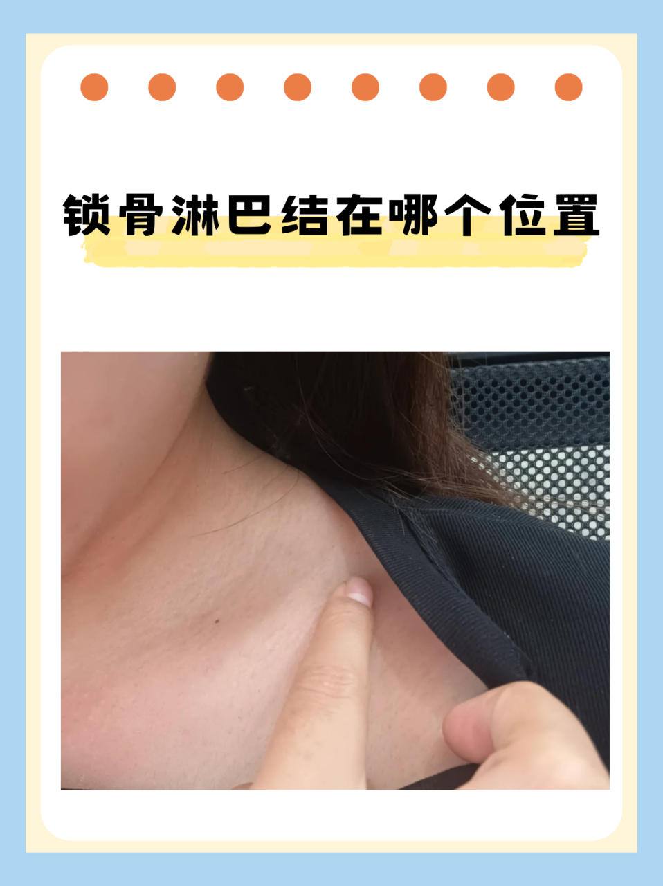 锁骨淋巴结在哪个位置 锁骨淋巴结是人体淋巴系统中的重要组成部分