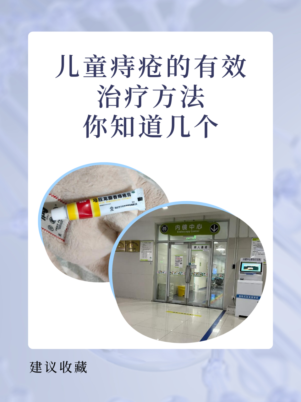 儿童痔疮怎么治疗 痔疮在成人中较为常见,但近年来,儿童患痔疮的情况