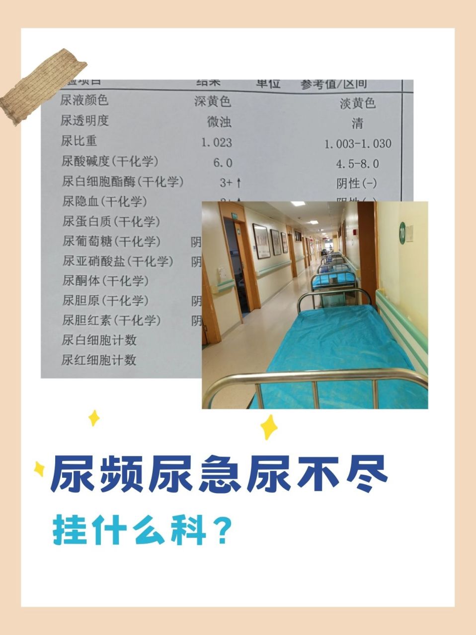 女的小便疼是挂什么科（女的小便疼是挂什么科室的号）