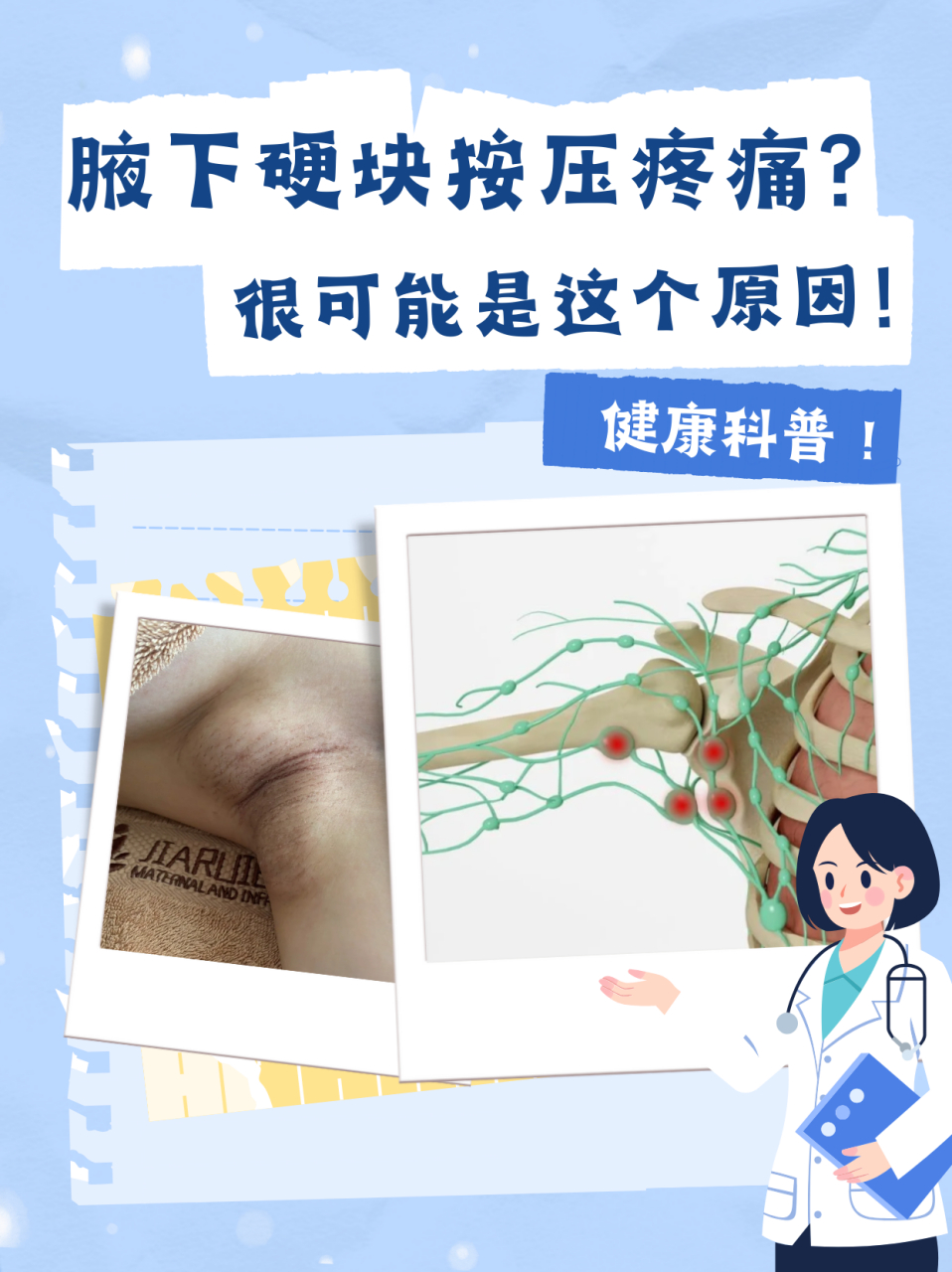 腋下有硬块按压疼痛的原因有哪些 94今天,我想和大家聊聊腋下有硬块