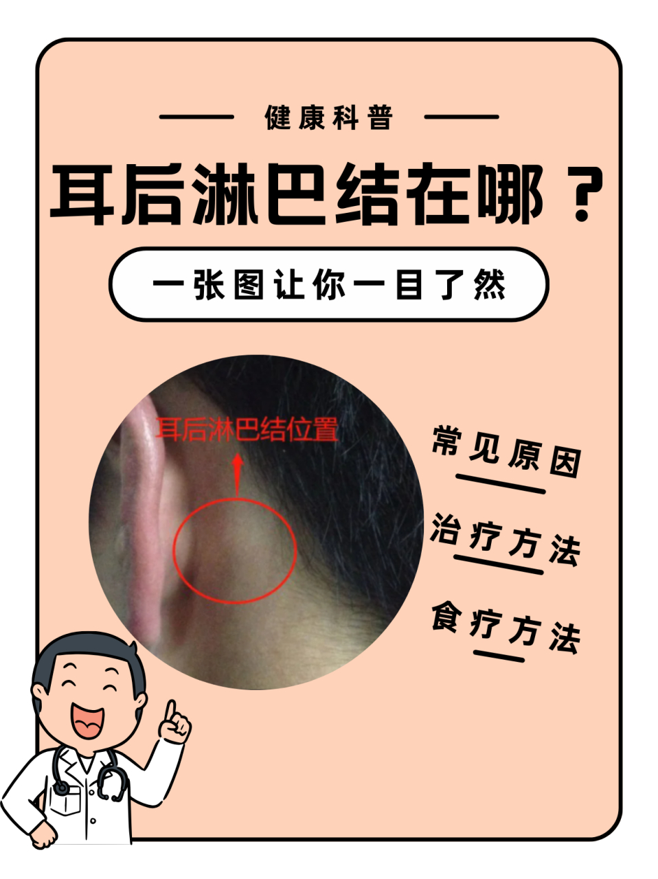 耳后淋巴结在哪 94你是否曾经好奇,耳后那块柔软的区域里隐藏着哪些