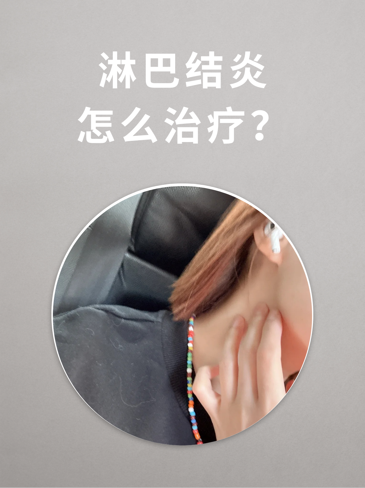 淋巴结炎怎么治疗 面对淋巴结炎,心中难免充满疑惑.