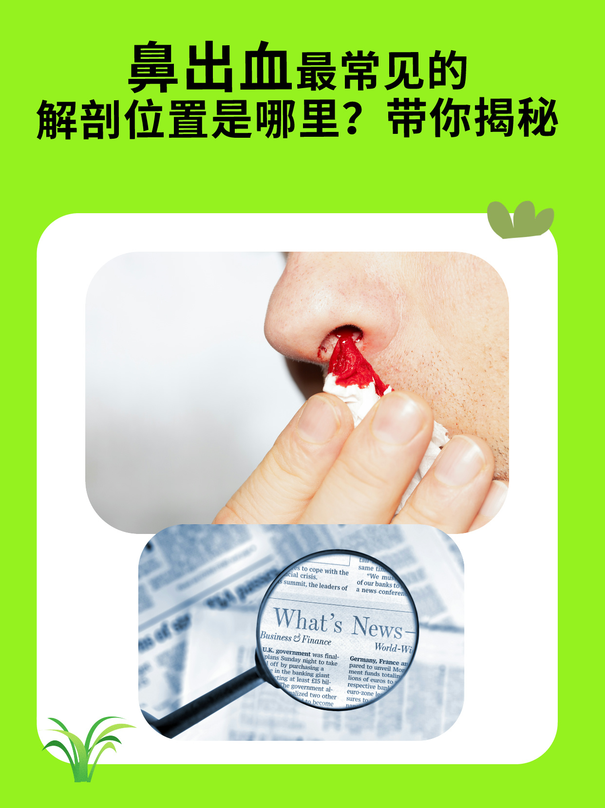 鼻出血最常见的解剖位置是鼻中隔前下方的黎氏区