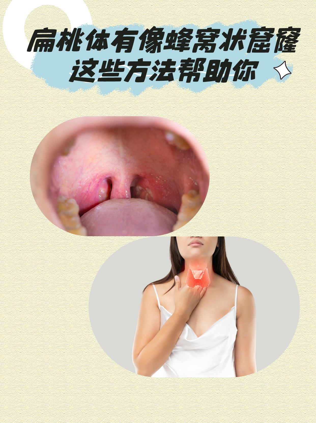 扁桃体有像蜂窝状的窟窿怎.@普通外科管蔚医生的动态