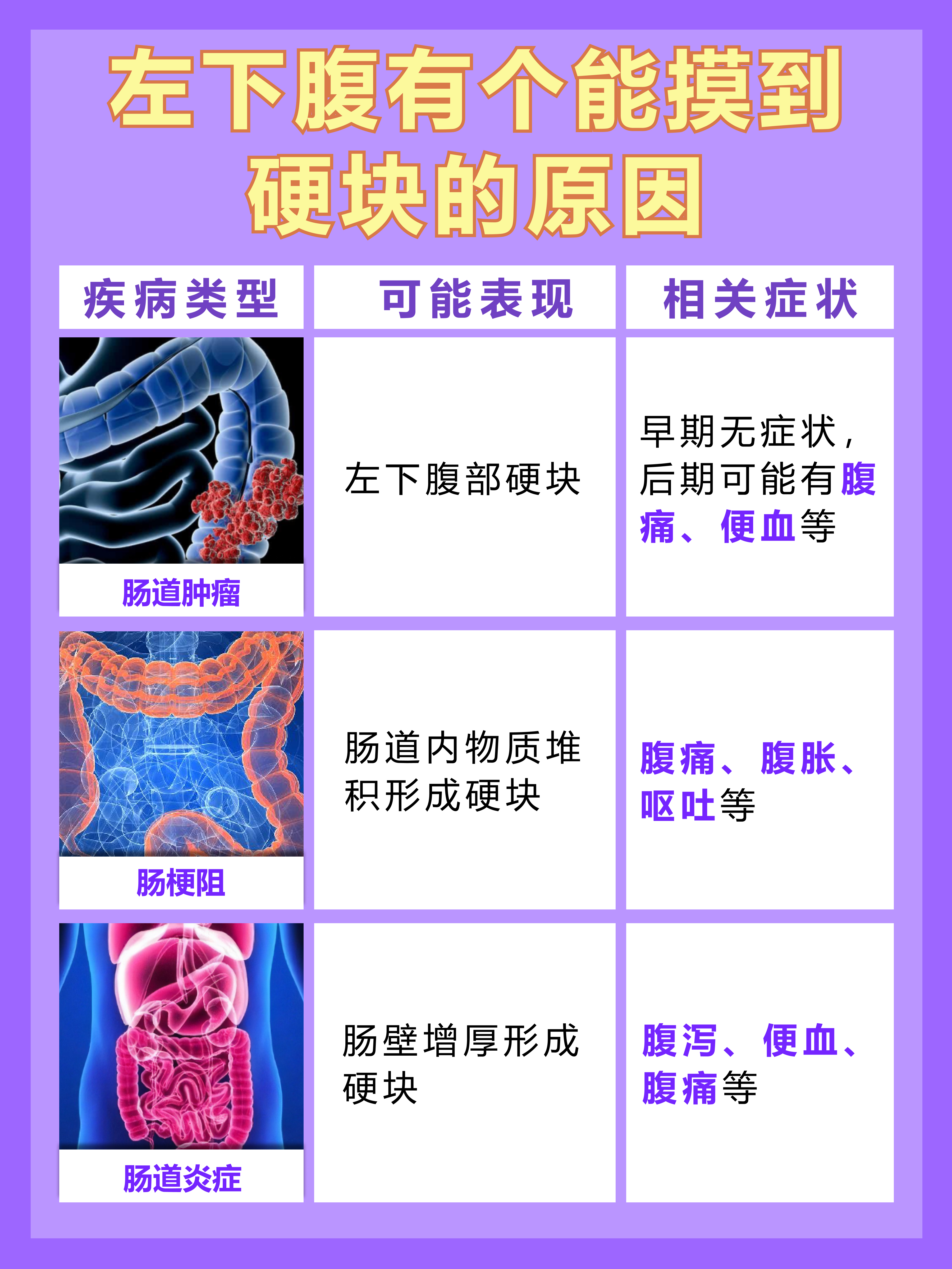 医生解惑:左下腹有个能摸到硬块怎么回事  在日常生
