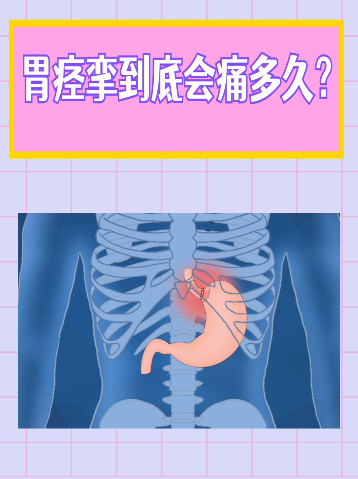 为什么胃痉挛
