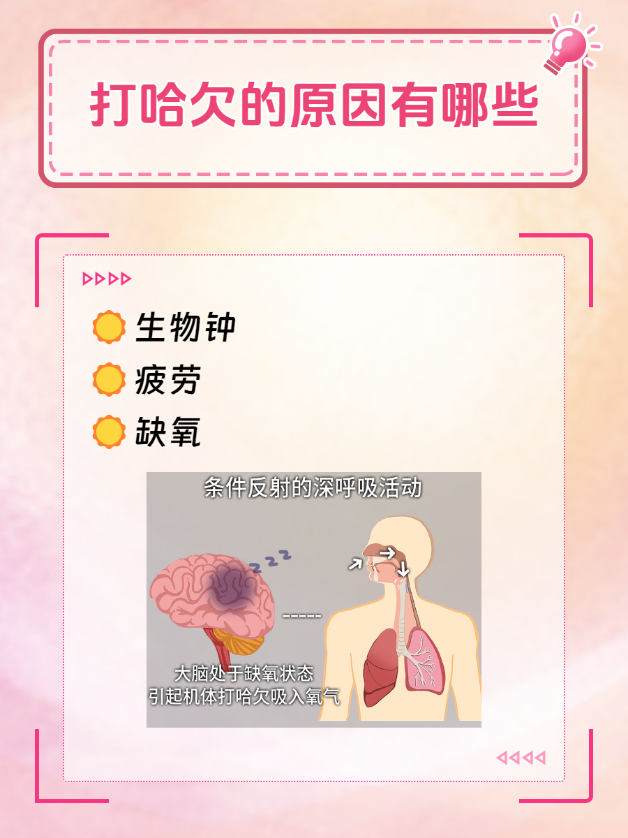 为什么总是困呢 为什么总是困呢