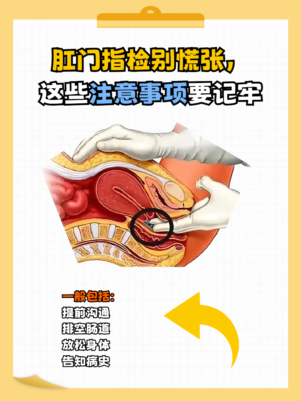 肛门指检别慌张,这些注意事项要记牢