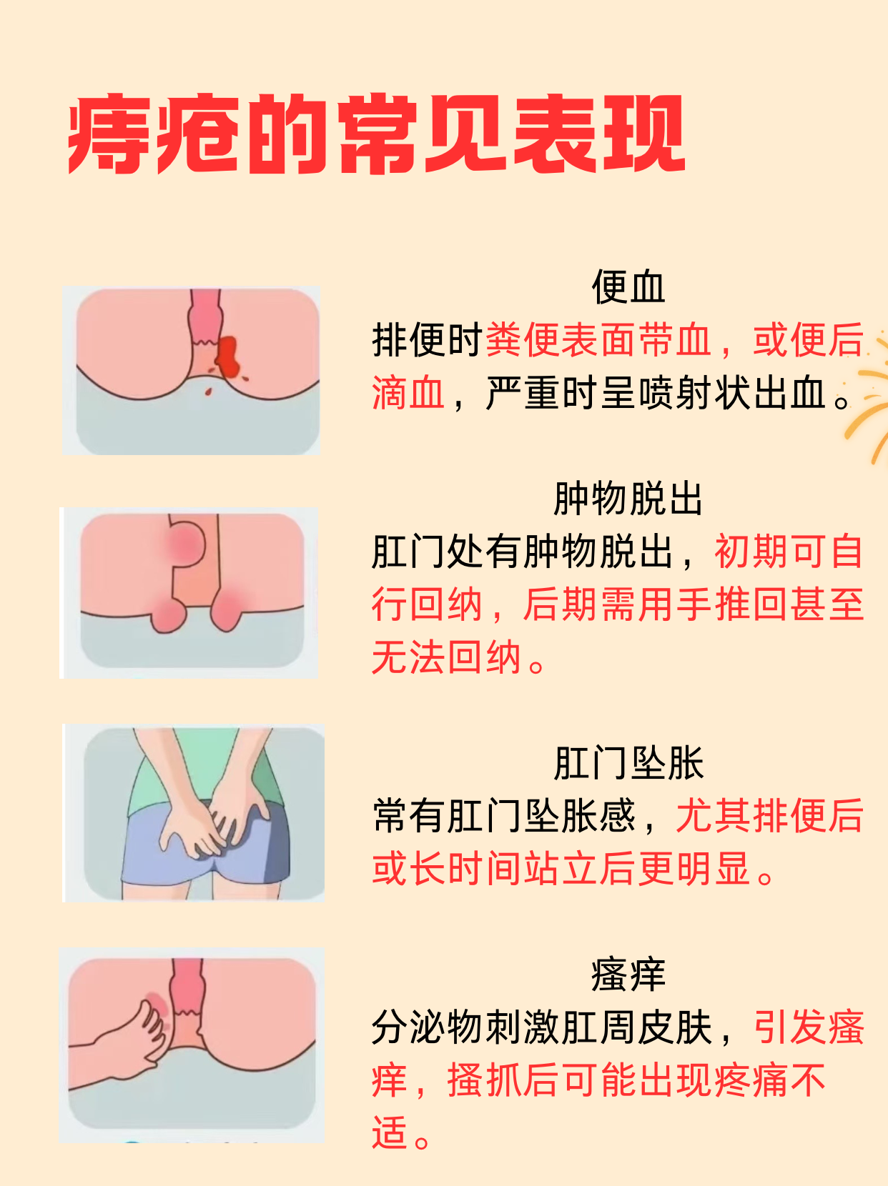 肛门那颗若隐若现的肉球,坐着像针扎,擦屁屁像开