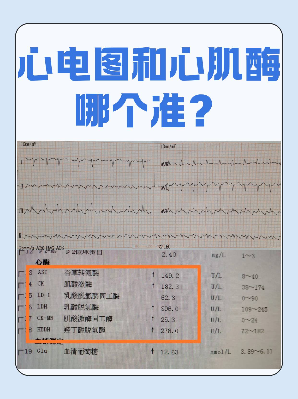 心肌酶变化图片