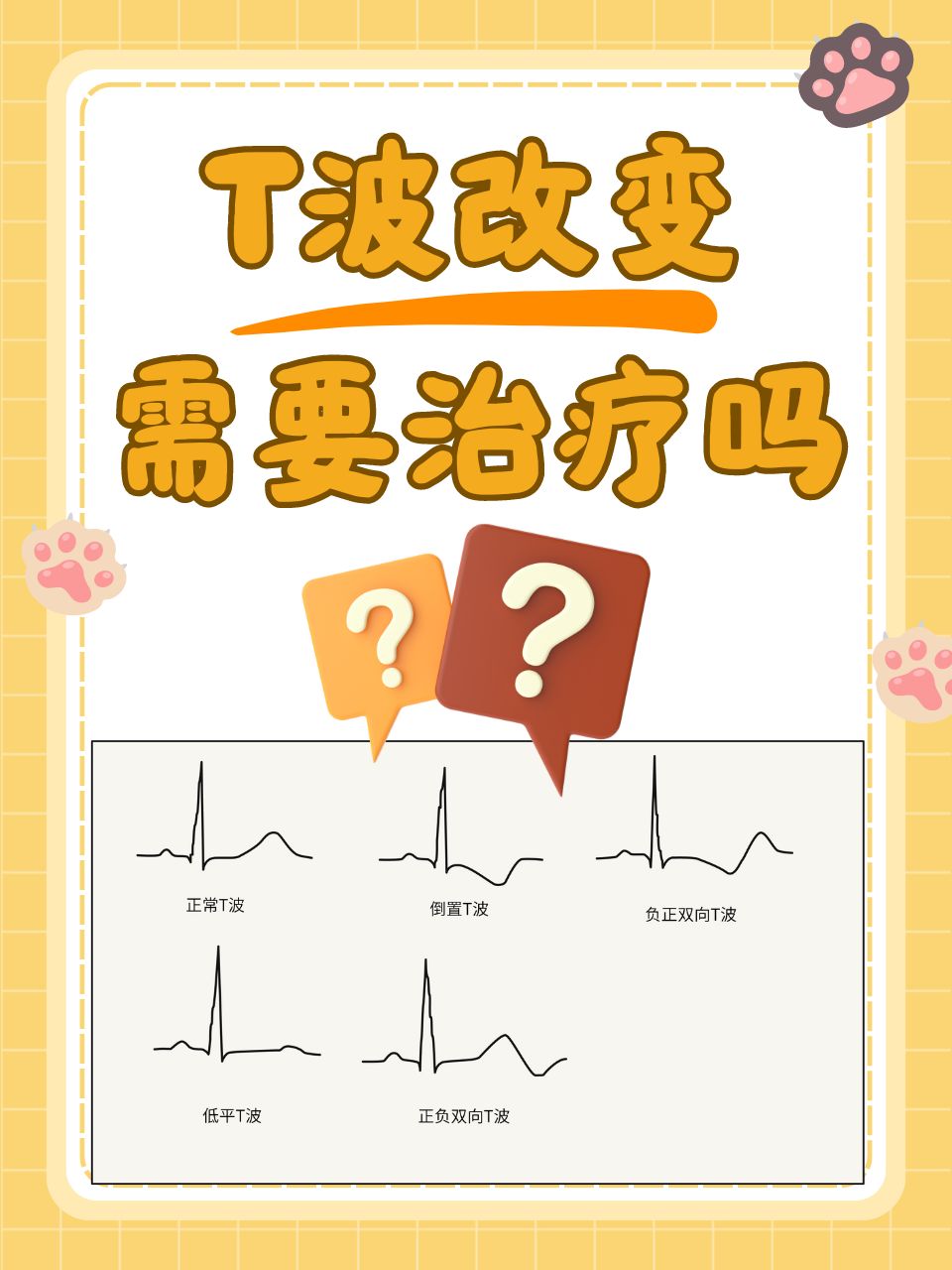 t波改变需要治疗吗?