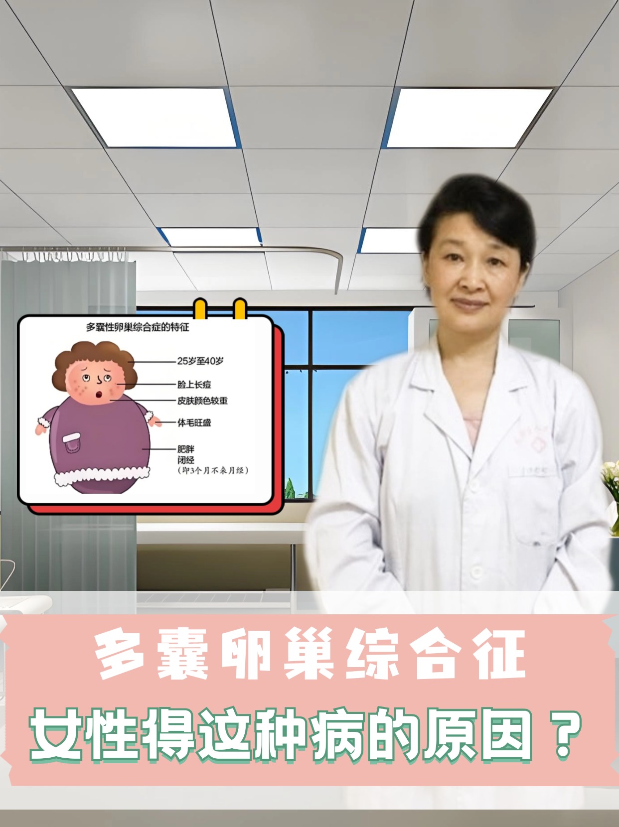 多囊性卵巢综合症病