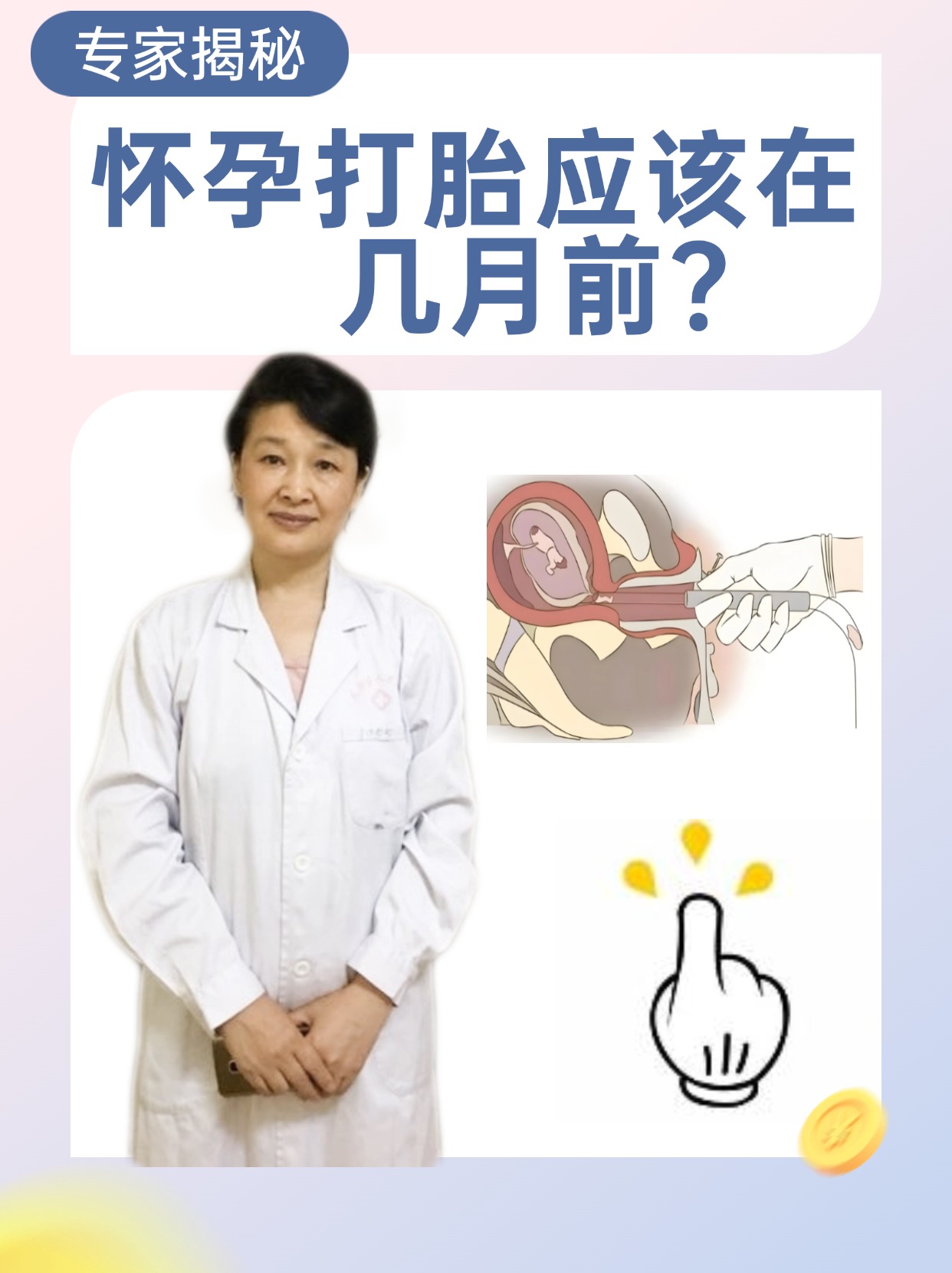 怀孕打胎是指通过医疗手段终止妊娠即人工终止胎儿在母体内的发 