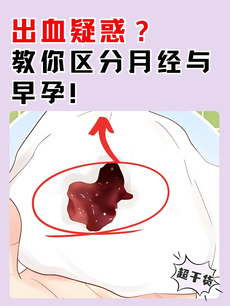 为什么怀孕了还会流血