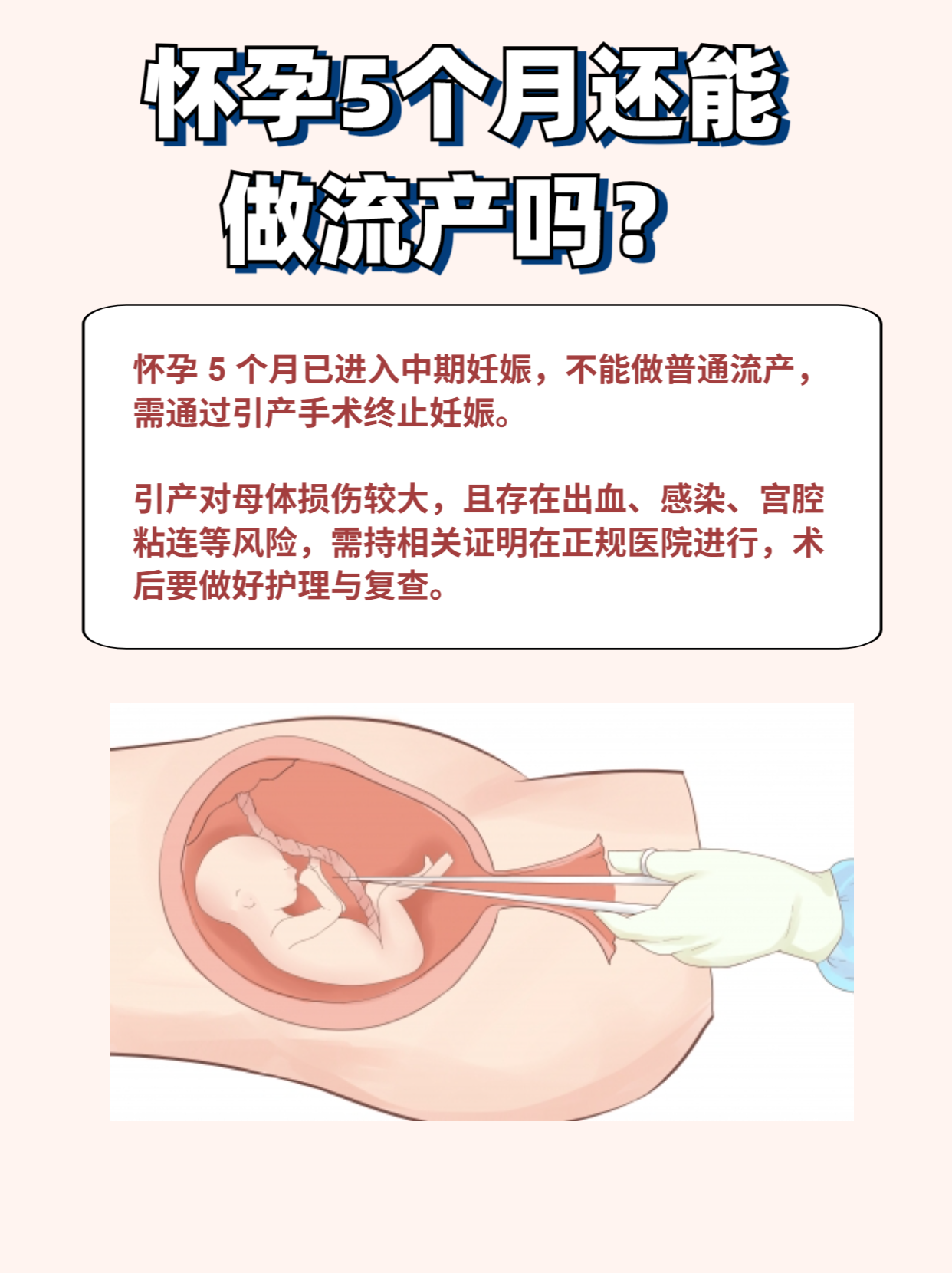 最新消息在家堕胎最好方法分享(你知道在家堕胎最好方法是什么吗？)