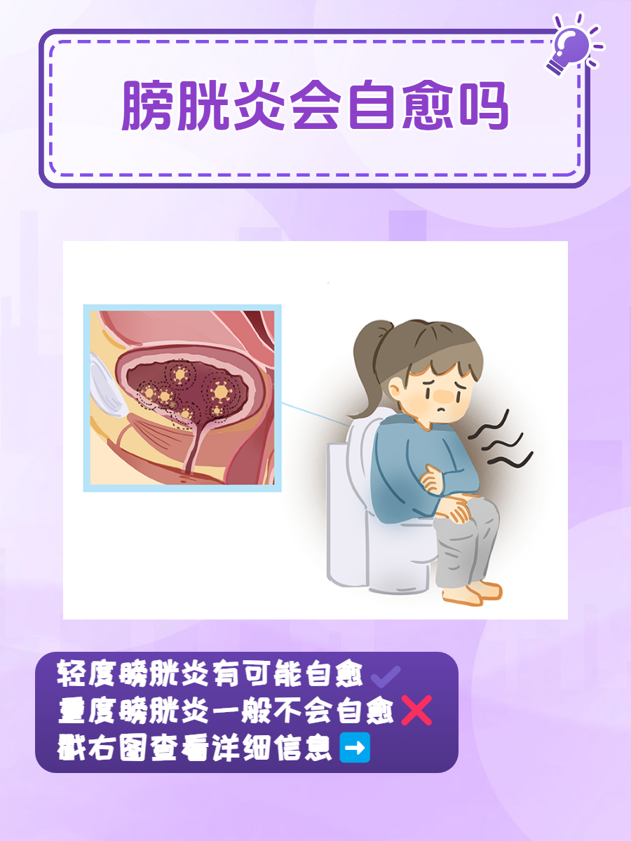 膀胱炎,这个听起来就让人不太舒服的词汇,其实是泌尿