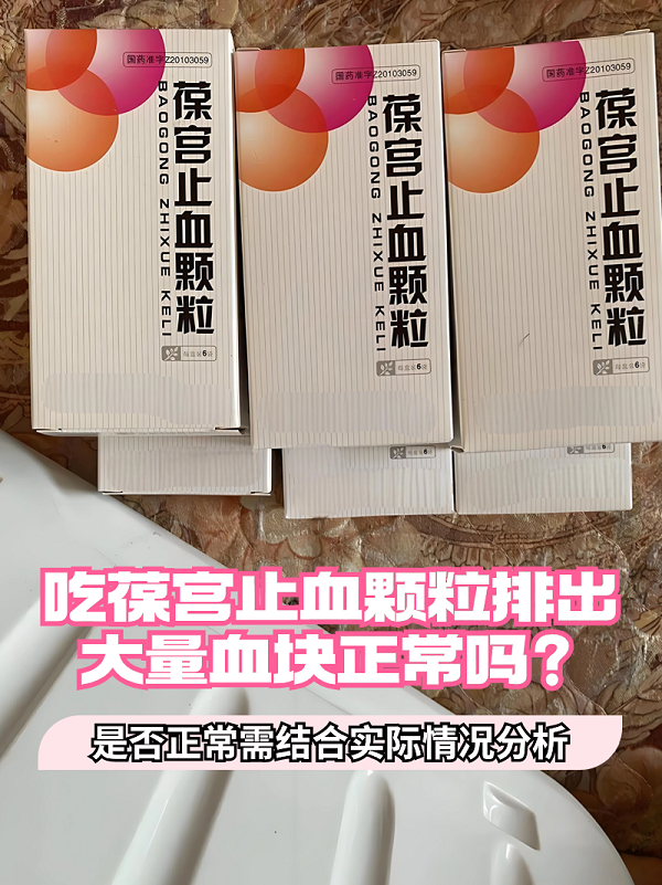 葆宫止血颗粒一般能改善妇科疾病,它可以固经止血,滋阴清热