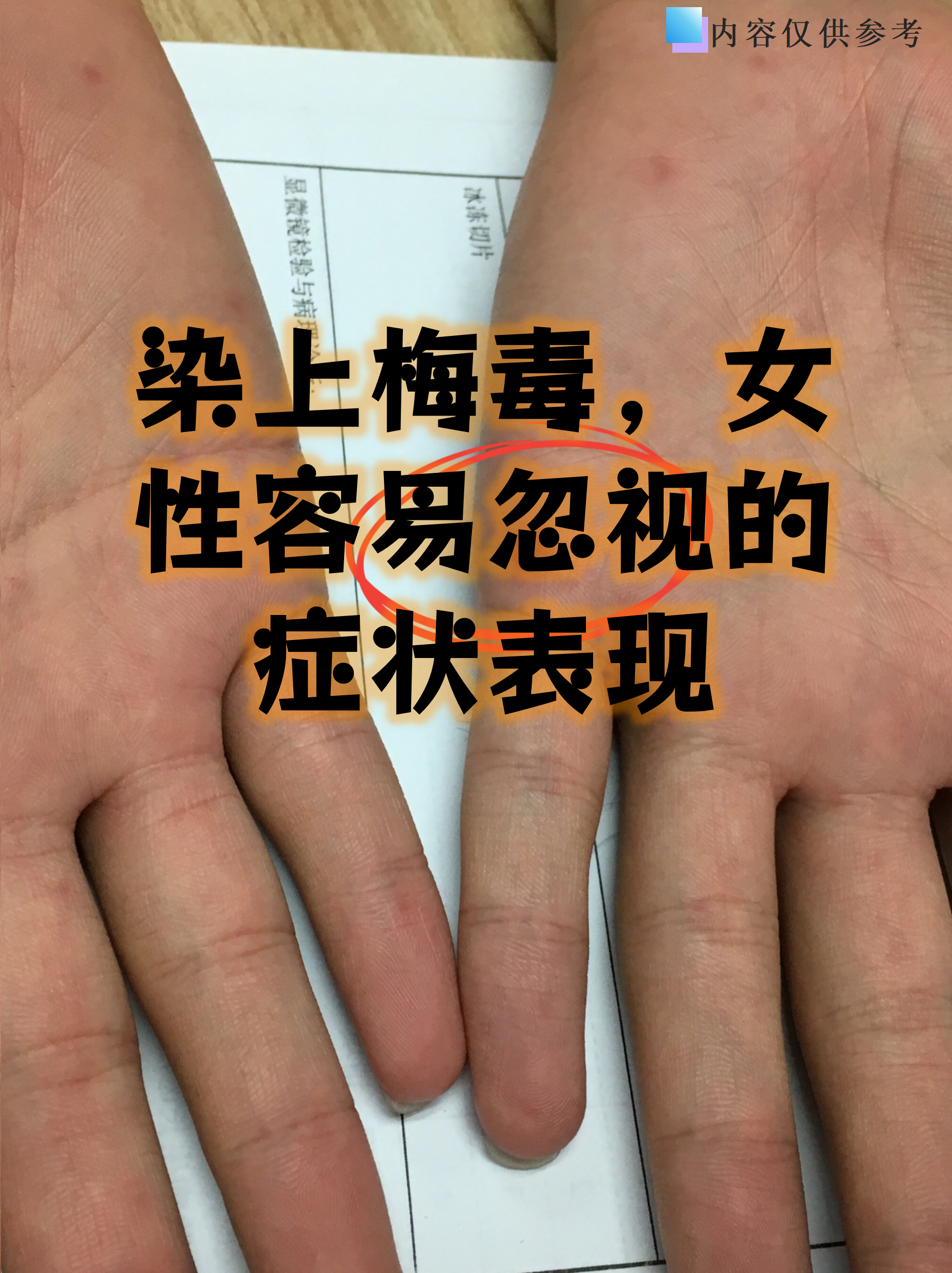 染上梅毒,女性容易忽视的症状表现