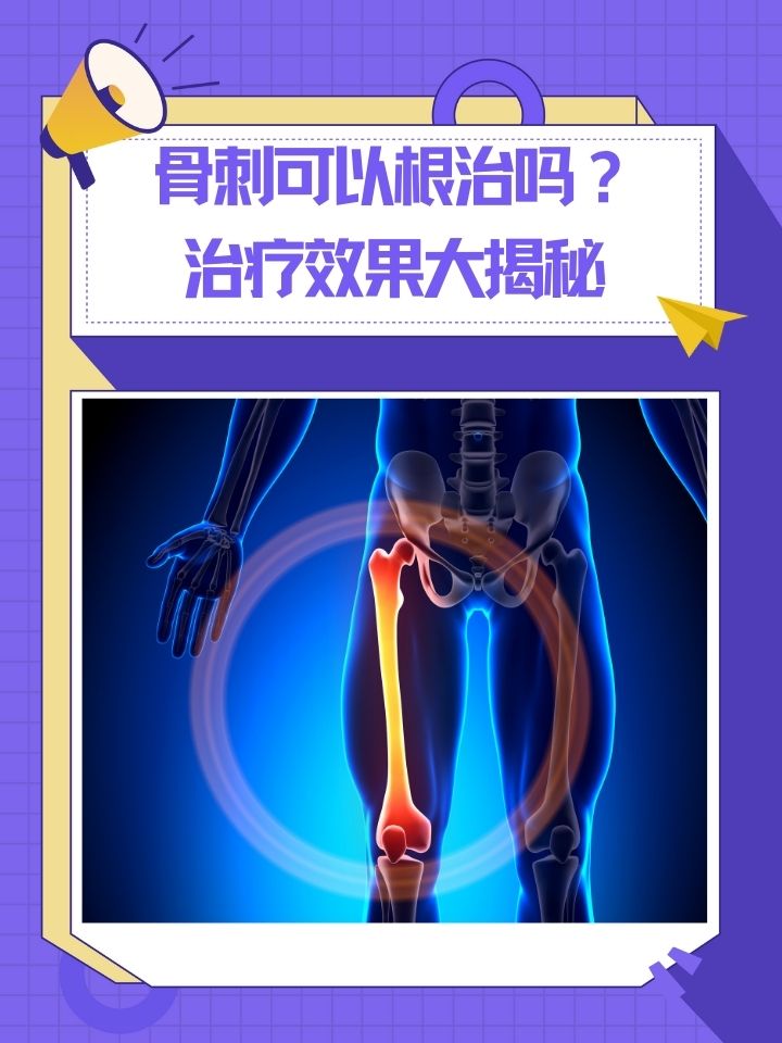 为什么长骨刺?百科在线 为什么长骨刺?百科在线