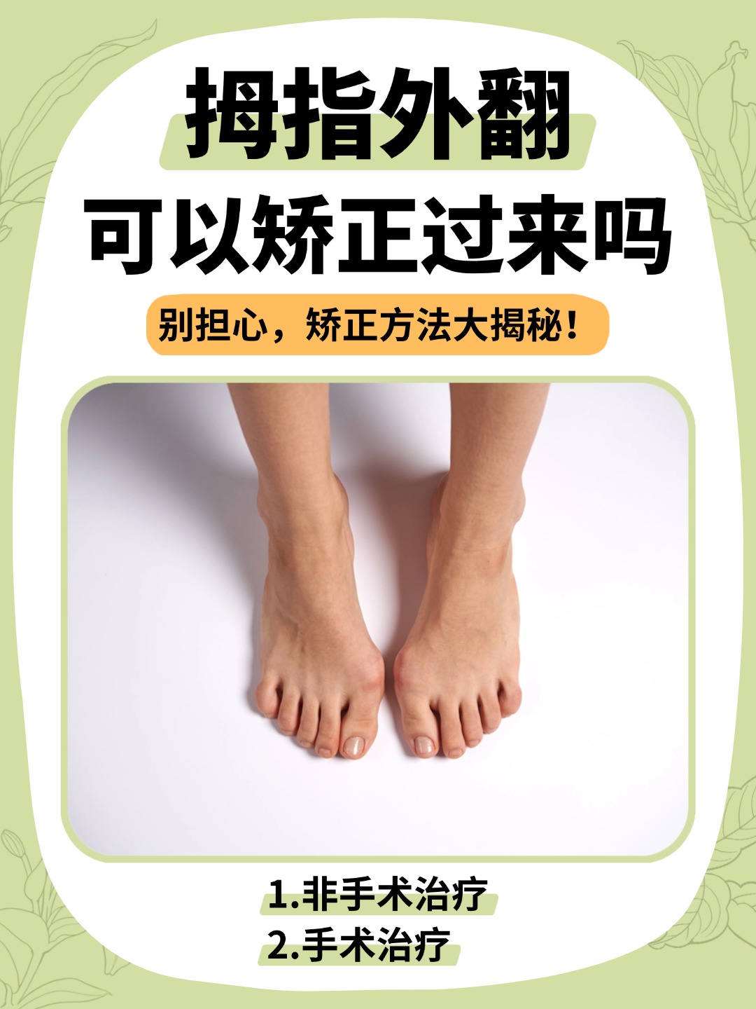 拇指外翻可以矫正过来吗?别担心,矫正方法大揭秘!