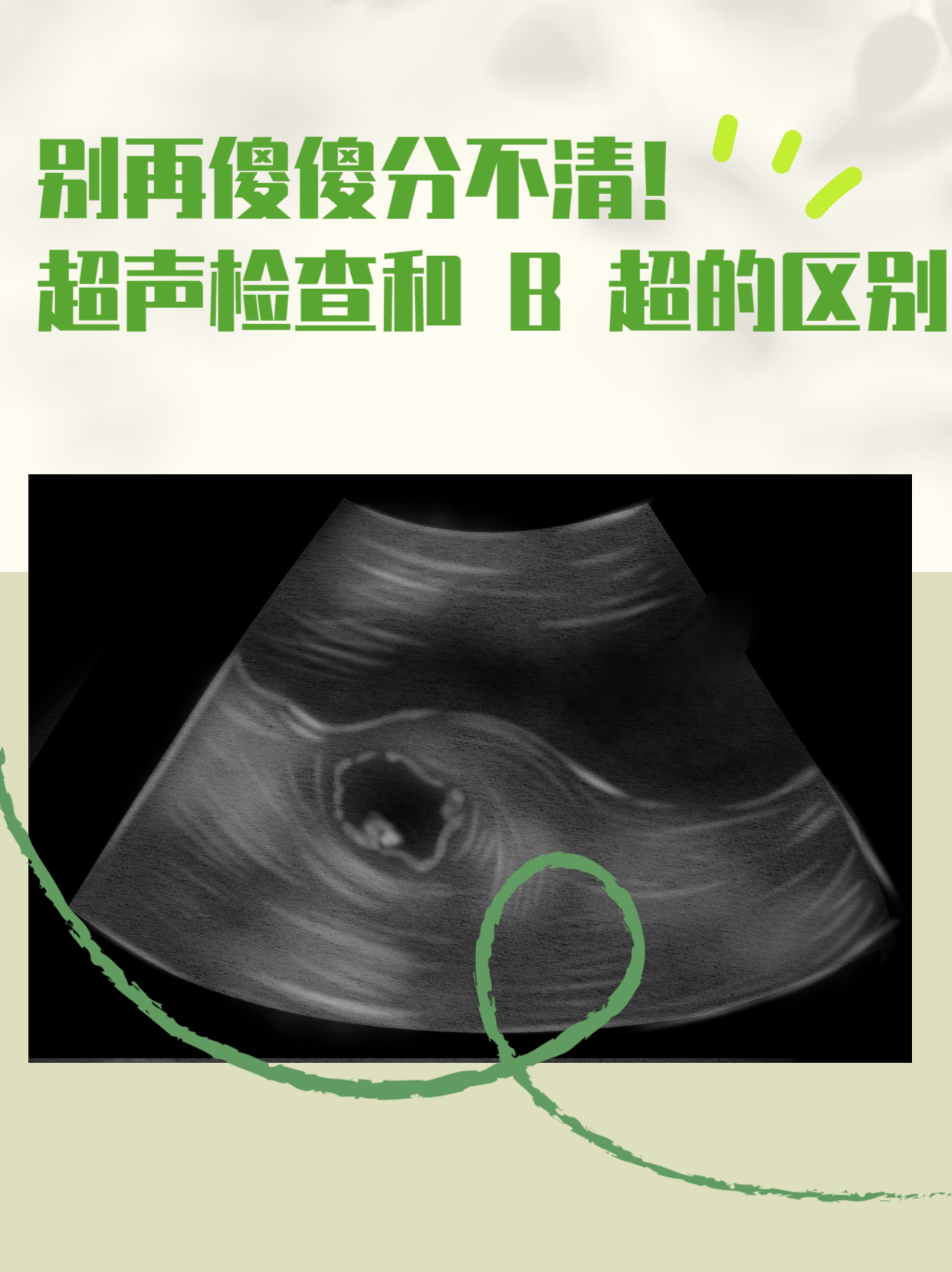 别再傻傻分不清!