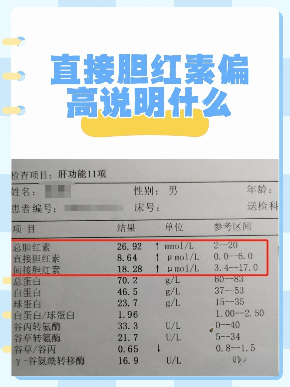 其中,"直接胆红素偏高"这一结果,往往让不少人感到困惑和担忧