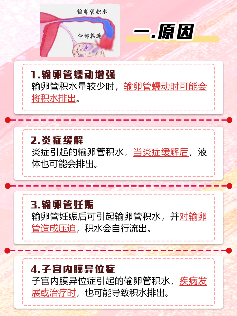 输卵管为啥会堵塞的原因为什么在线 输卵管为啥会堵塞的原因为什么在线