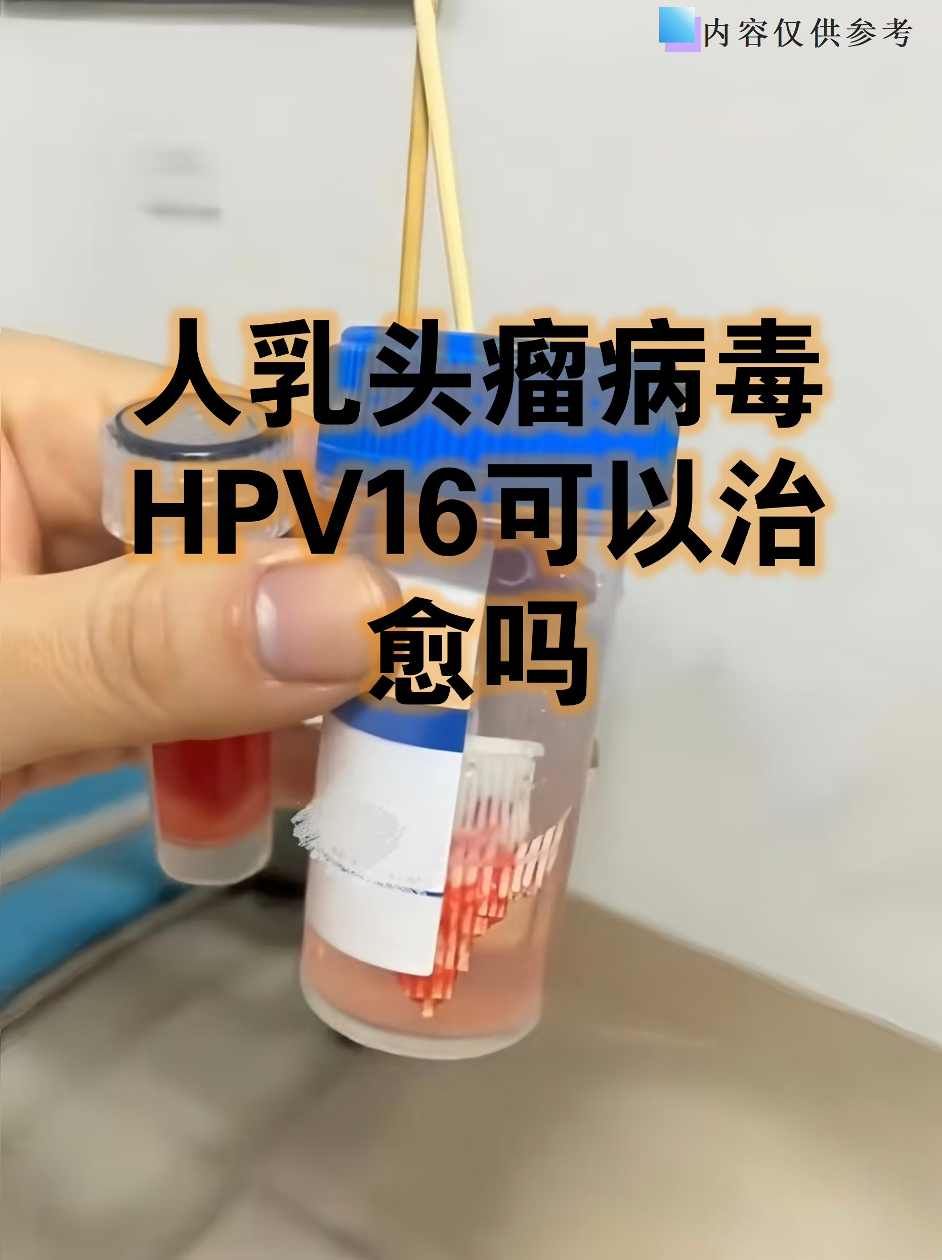  高危型病毒31和56怎么治疗(高危病毒53是什么原因)