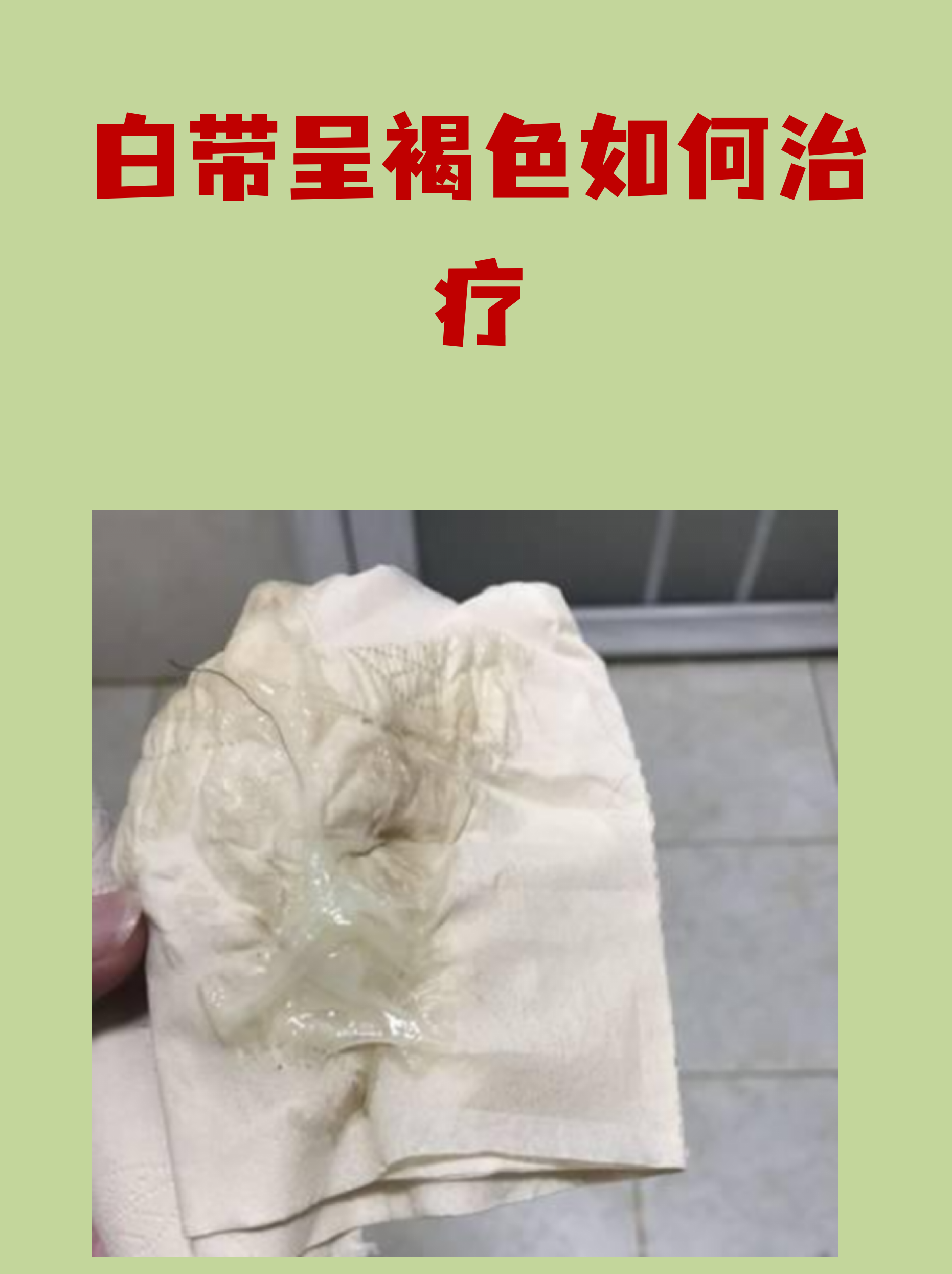 为什么会有褐色白带