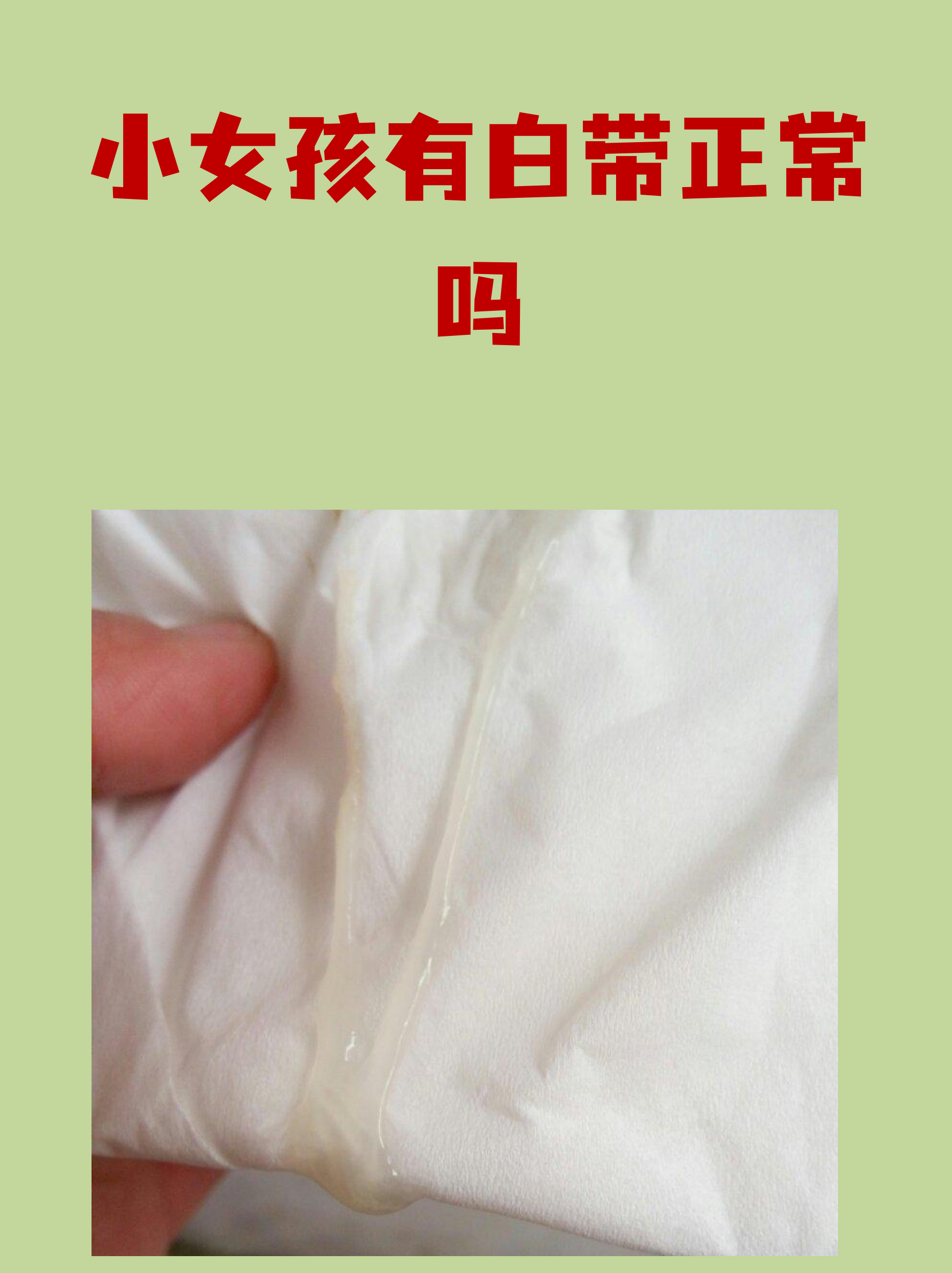 很多家长发现小女孩内裤上有白色分泌物时都会