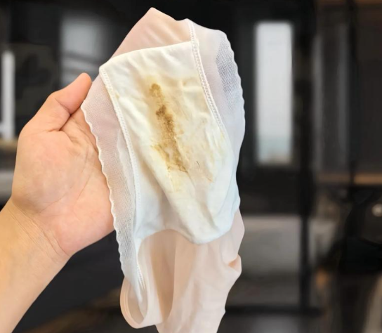 白带是女性健康的晴雨表,颜色变化确实可能与月经周期有关,但发黄