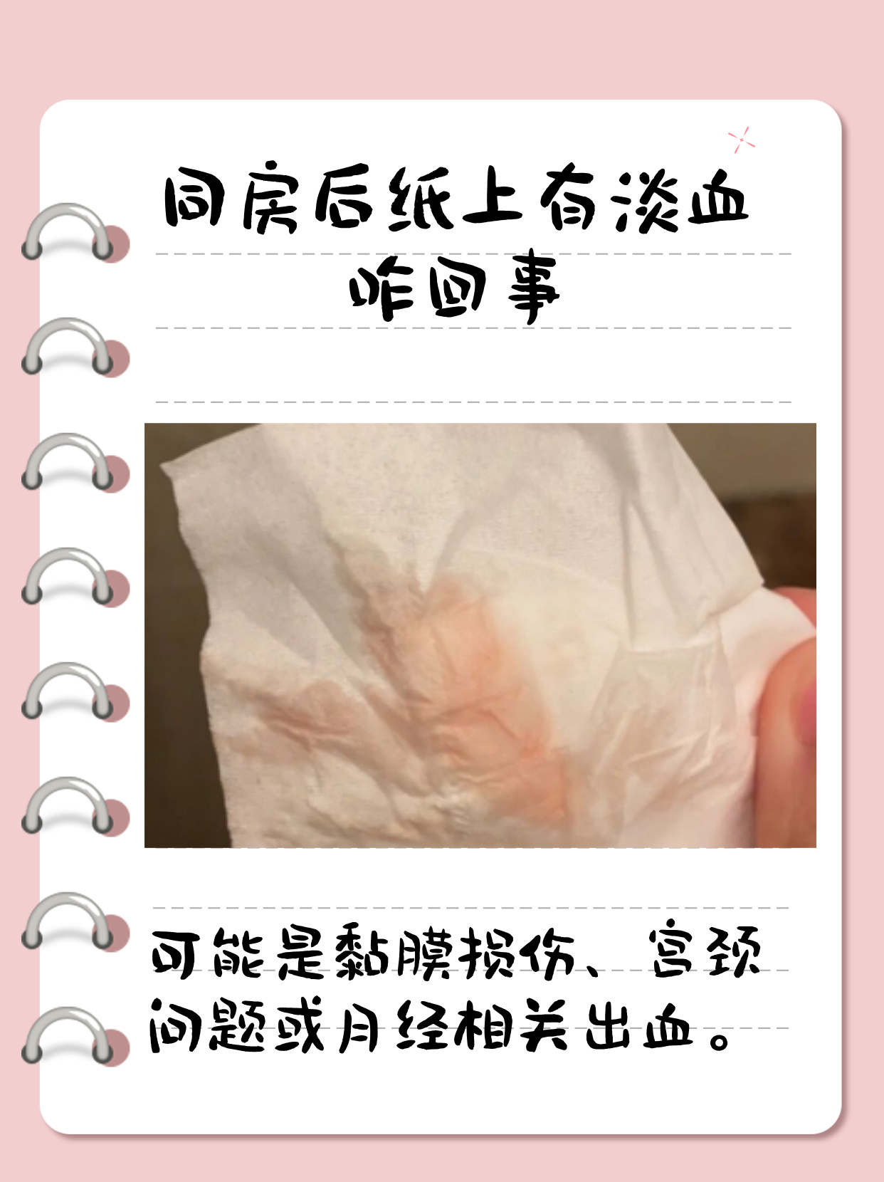 同房后擦纸上有点淡淡的血 同房后纸上有淡血?