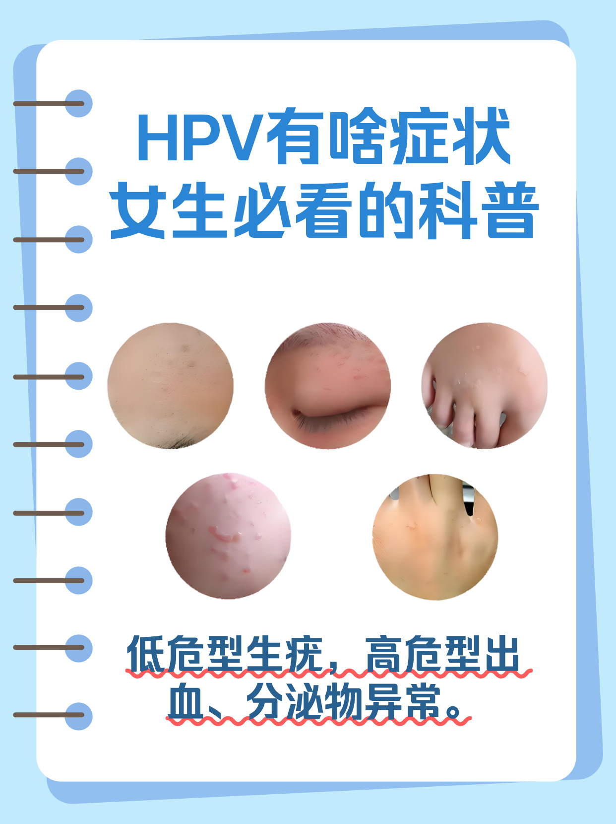 女性为什么会感染hpv
