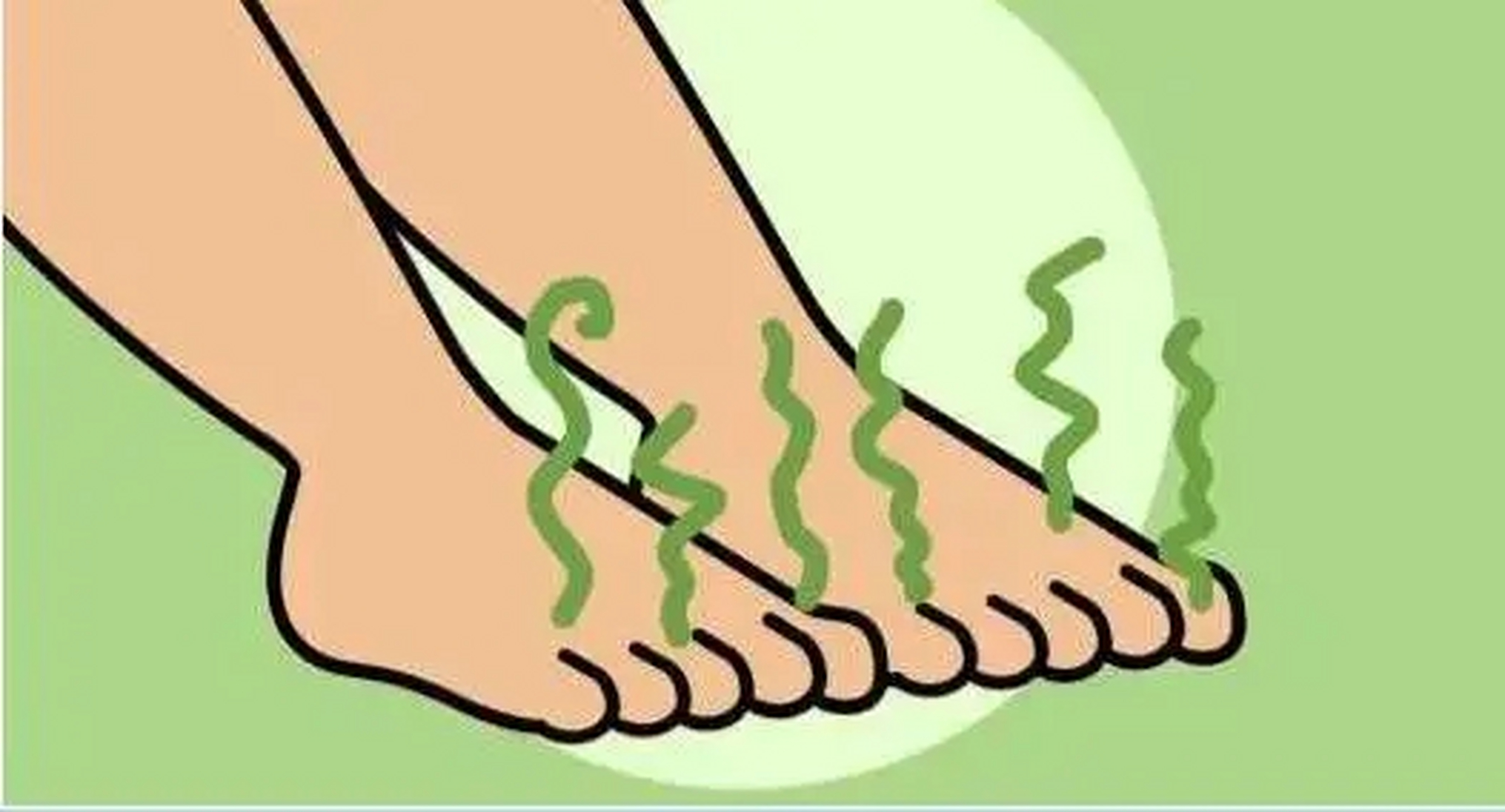 脚气严重的症状主要包括脚趾间起水疱,脱皮或皮肤发白湿软,也可出现