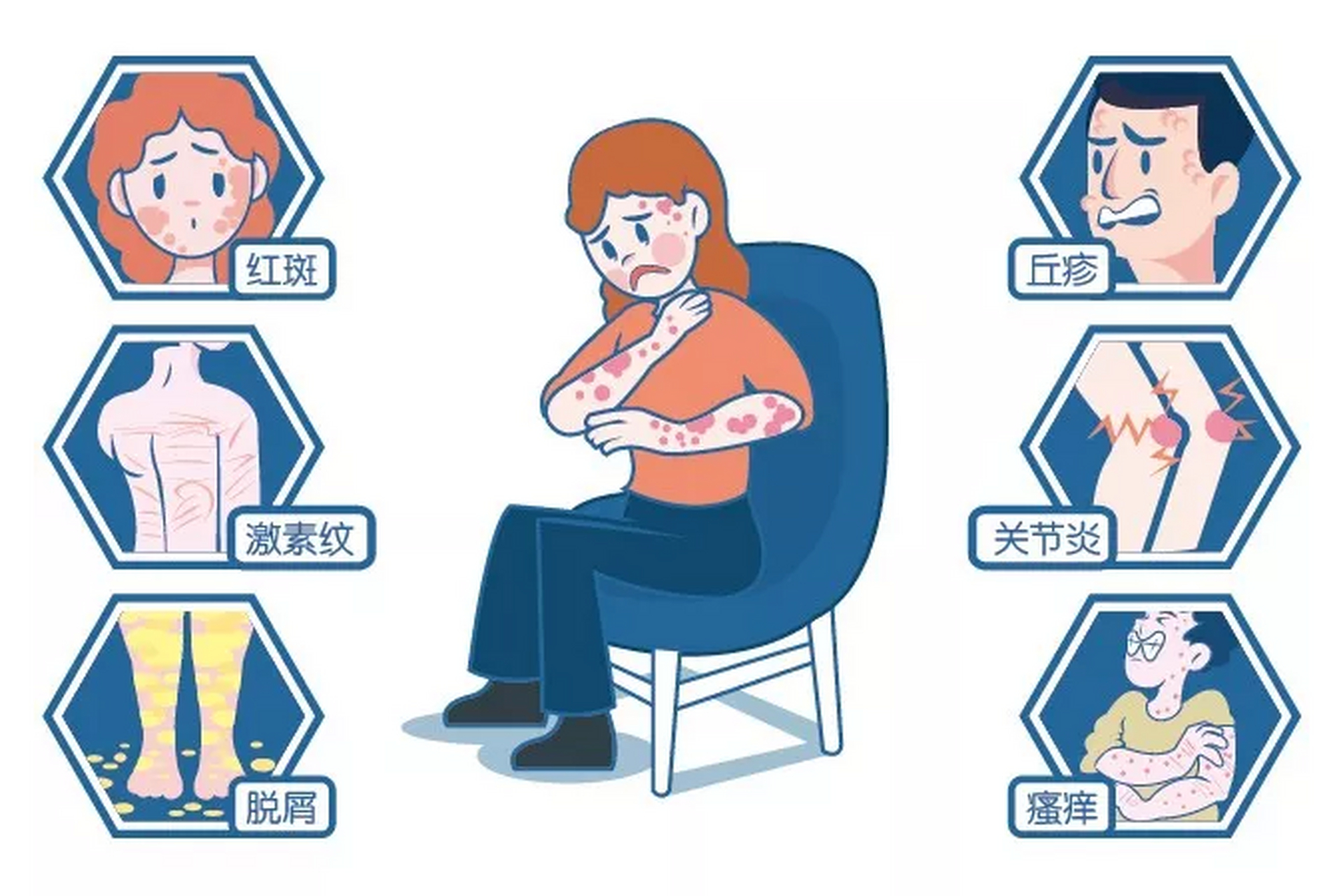 牛皮癣是一种常见的具有特征性皮损的慢性易于复发的炎症性皮肤病