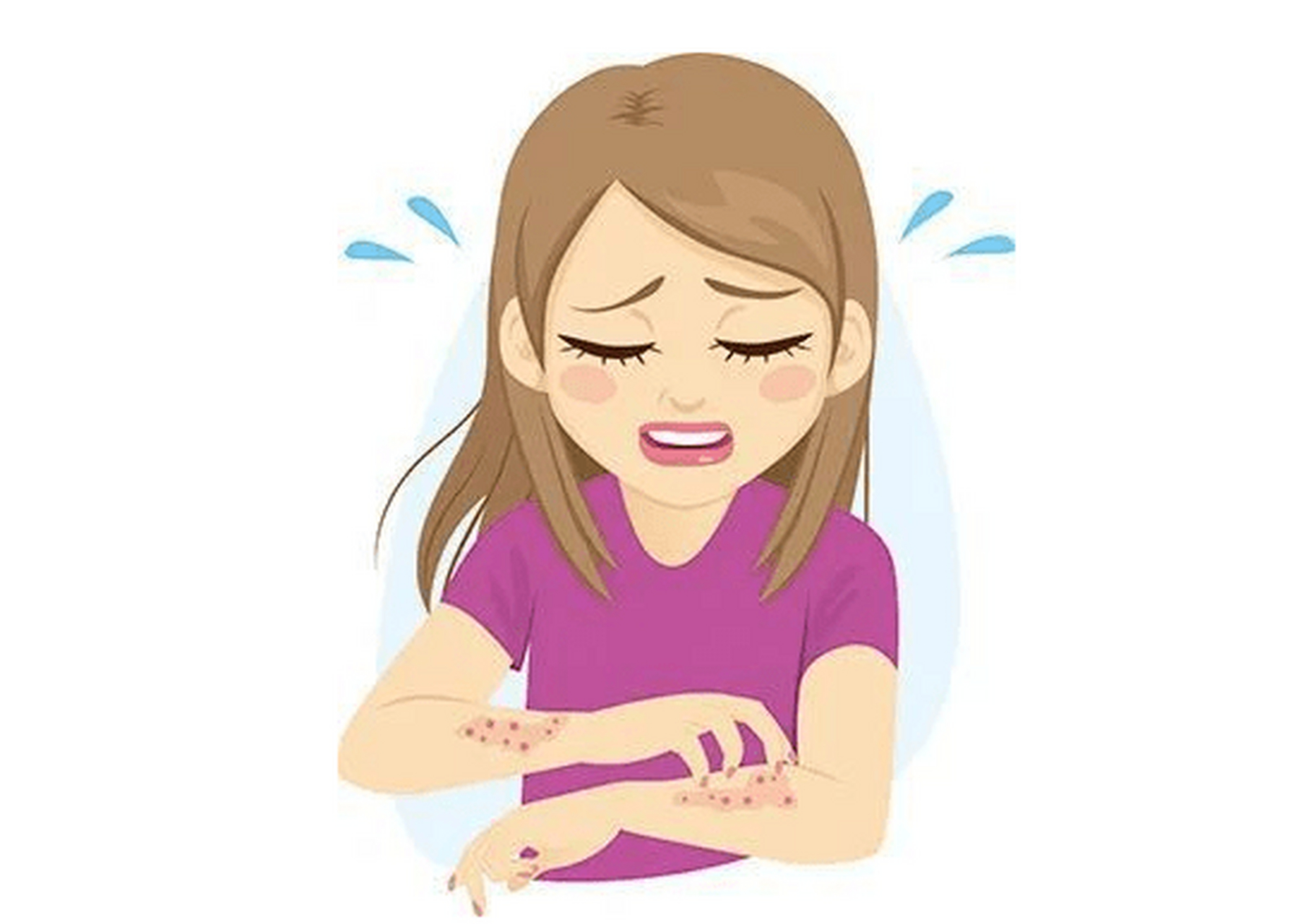 过敏性皮炎是由于皮肤接触过敏原而引起的炎症反应.