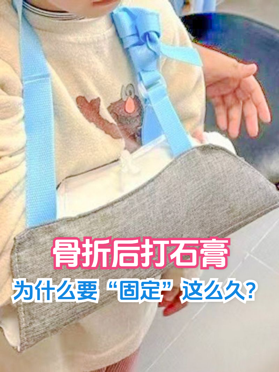 骨折为什么要打石膏再做手术为什么在线 骨折为什么要打石膏再做手术为什么在线