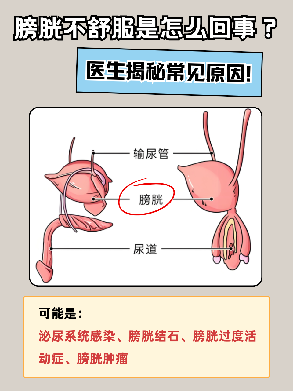 膀胱不舒服是怎么回事?医生揭秘常见原因!