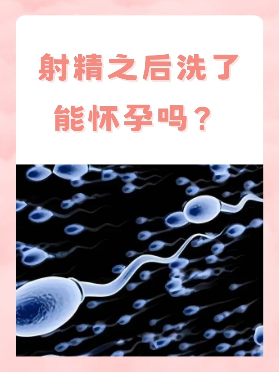 在家做人工授精怀孕了图片