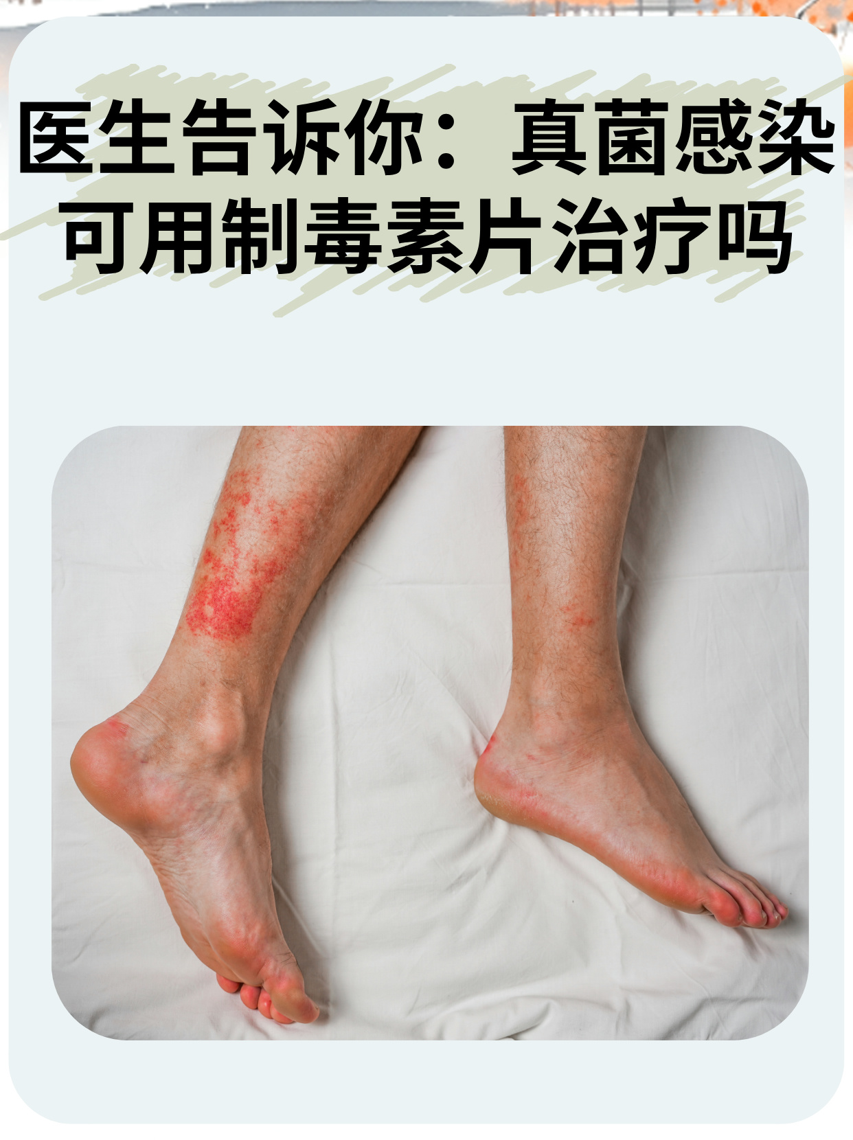 它可能发生在身体的任何部位,如皮肤,指甲,口腔,阴道等,带来瘙痒,疼痛