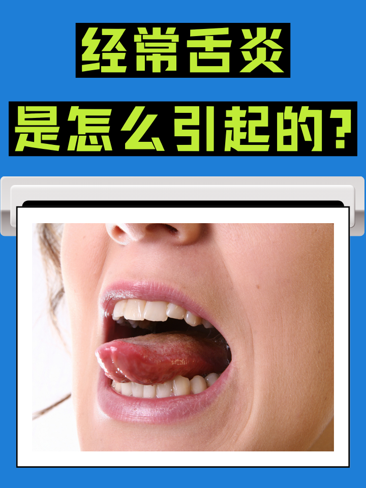 为什么舌头疼