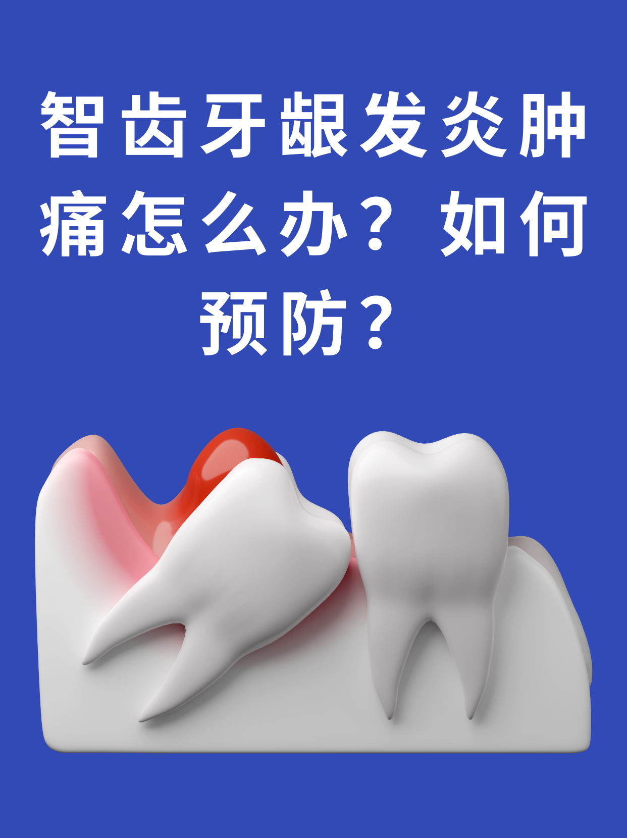为什么长智齿不疼