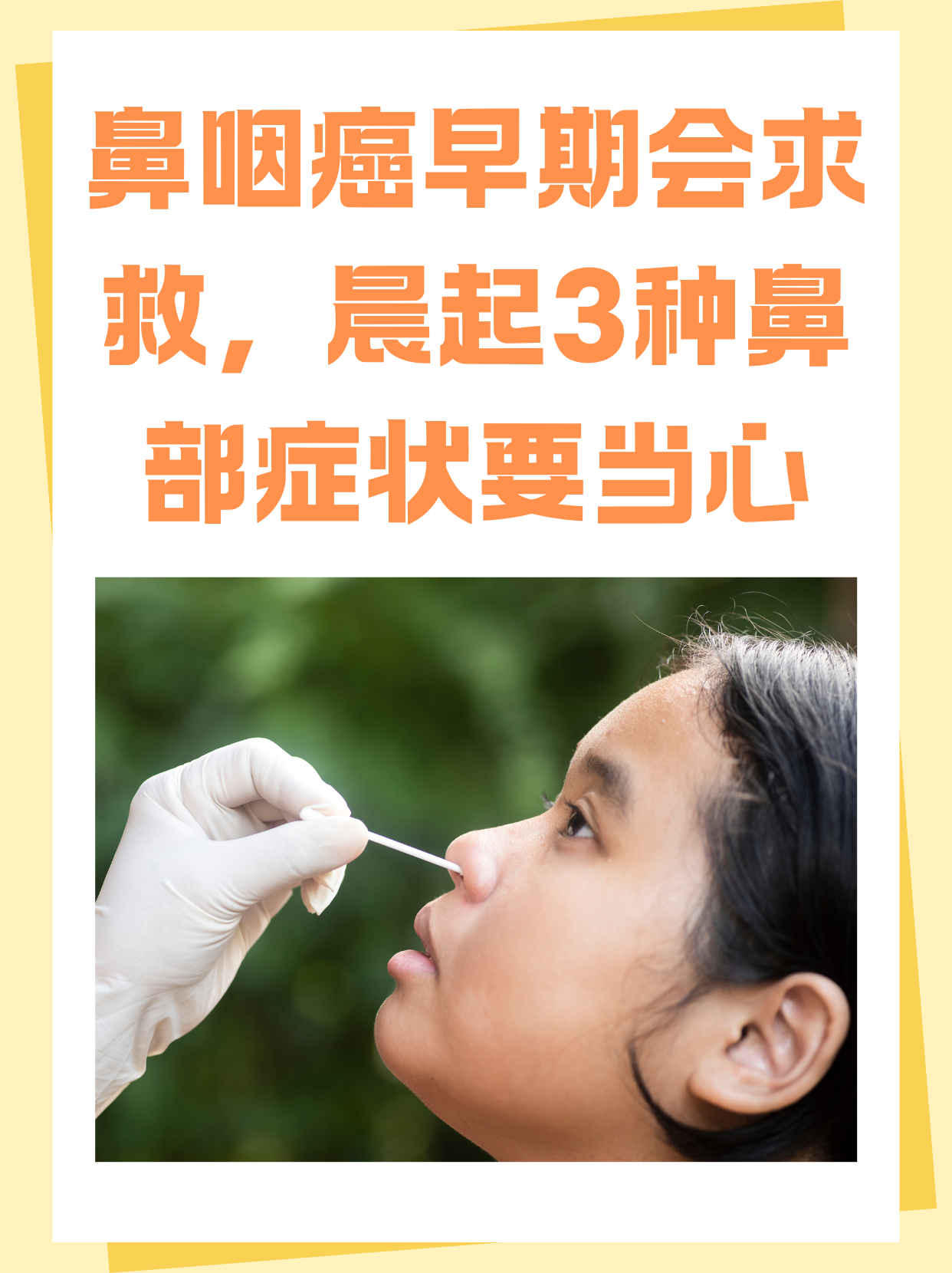 鼻咽癌早期会求救,晨起3种鼻部症状要当心