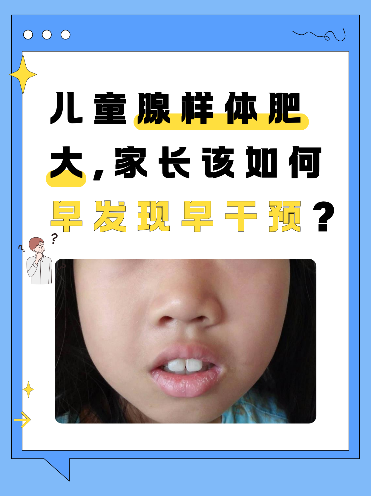 儿童腺样体肥大,家长该如何早发现早干预?