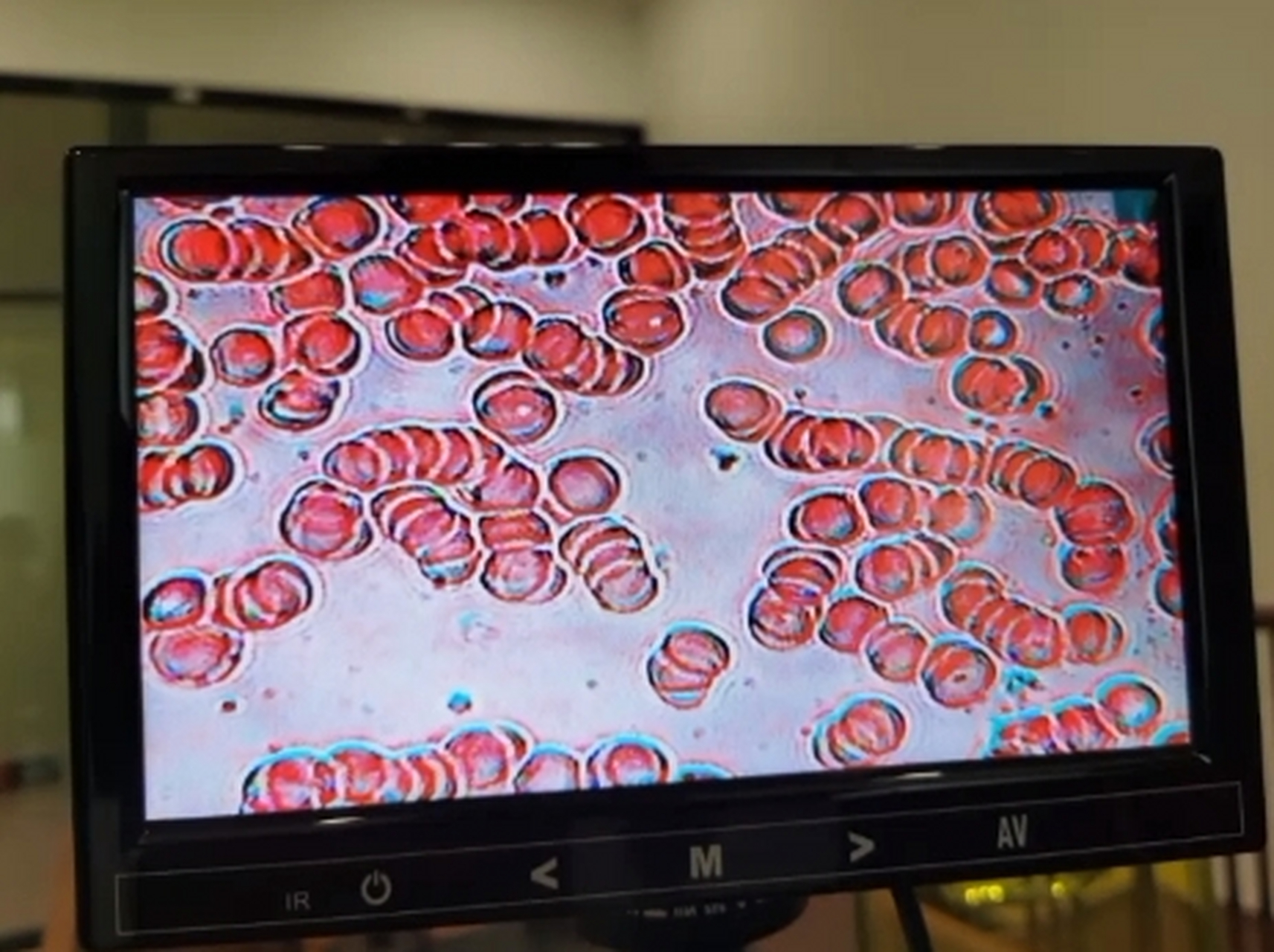 三个人的血在显微镜下的样子,哪个血最好?猜对有奖