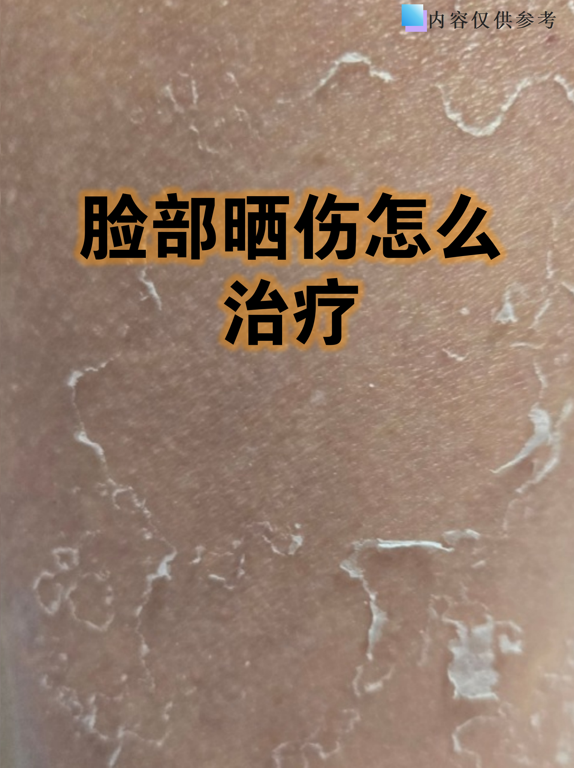 夏天紫外线强烈,脸部晒伤是常见问题,皮肤发红