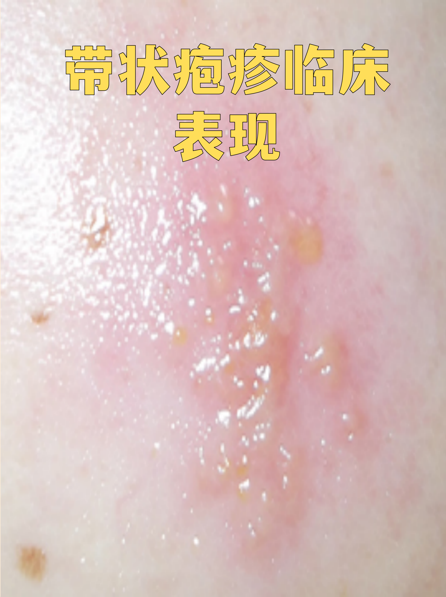  最近感染病毒的症状有哪些图片(最近感染病毒的症状有哪些图片大全)