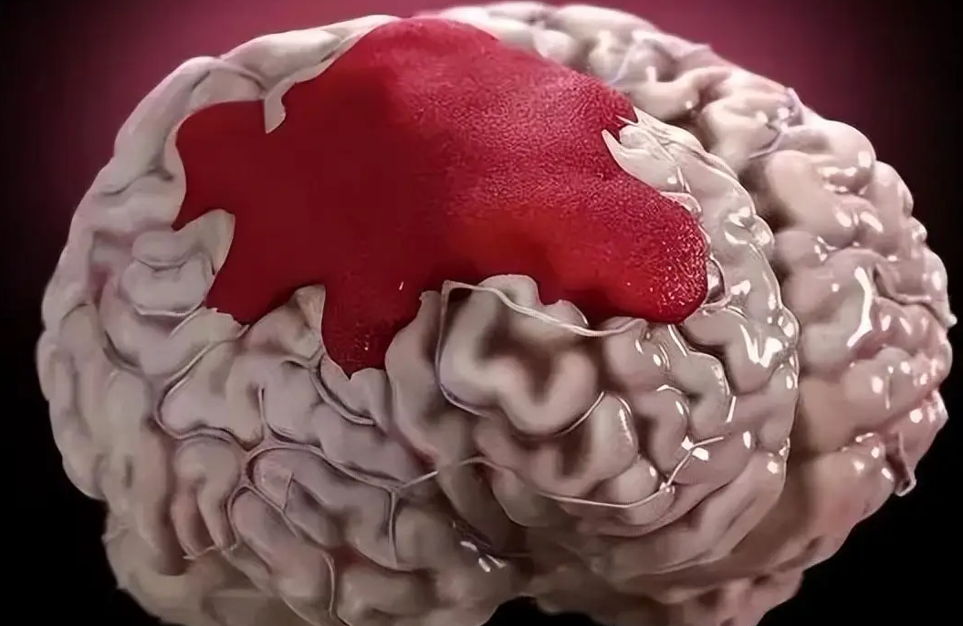 嗜睡,或者意识脑浆图片脑浆脑浆是什么颜色脑浆真实图片人脑浆图片脑